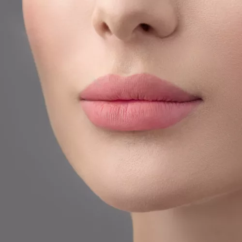 Before and after lip filler injections. Fillers. Lip augmentatio